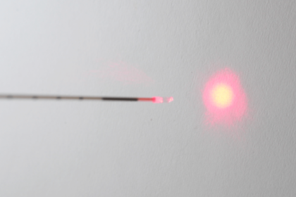 Laser varices